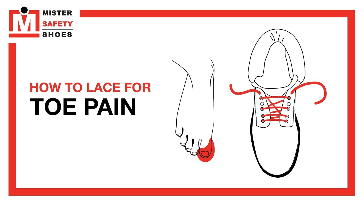 How to Lace for Toe Pain